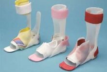 Ankle Foot Orthotics (AFOs)
